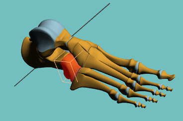 Blessures et cuboïde : tout savoir sur cet os essentiel du pied du coureur