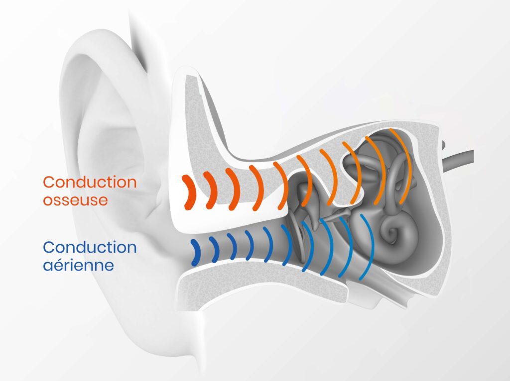 conduction osseuse